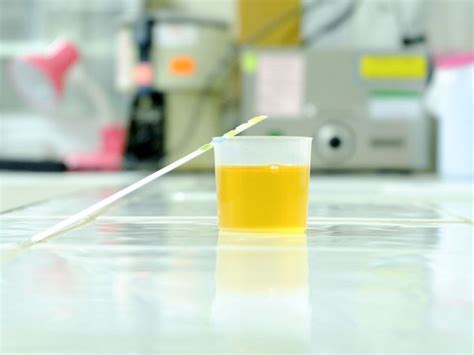 Urinalysis: Process, Results, and More