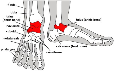 Osteochondral Lesion of the Talus | Torn Ankle Cartilage