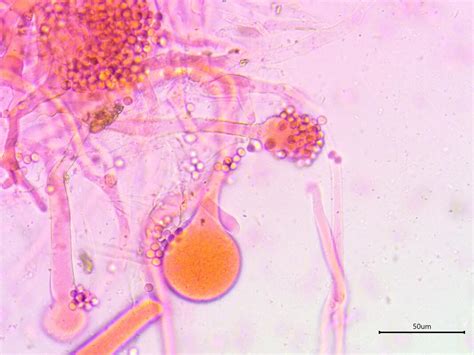 Tempeh (Rhizopus oligosporus) - 1001 Mushrooms Project - Alden Dirks