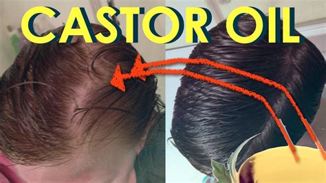 Castor oil for hair growth before and after photos – Stop hair loss with castor oil- Grow sexy ...