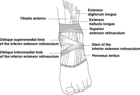 Tibialis Anterior Tendon and Extensor Retinaculum: Imaging in Cadavers and Patients with Tendon ...