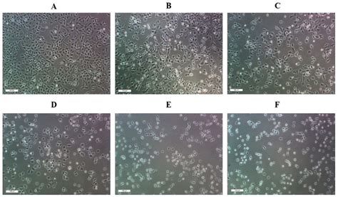 Morphology of A549 cells after a 24-h treatment with DMSO (A); 25, 50,... | Download Scientific ...