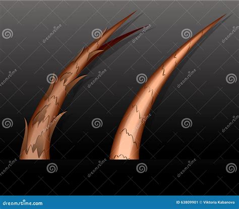 Split ends. treatment stock vector. Illustration of disease - 63809901