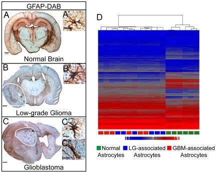 (A–C) GFAP immunohistochemistry of astrocytes in the normal brain (A ...