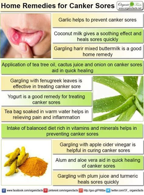 Pin by Audrey Herman on Holistic Home Remedies | Canker sore, Home remedy for canker sores, Cankers