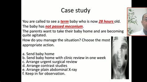 Case 77 failure to pass meconium, delayed passing stool, meconium plug ...