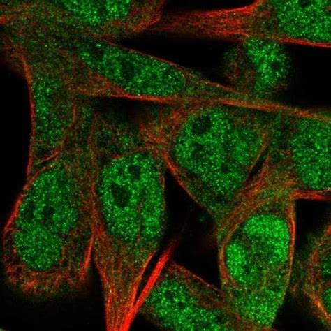 CREST Antibody (PA5-66230)