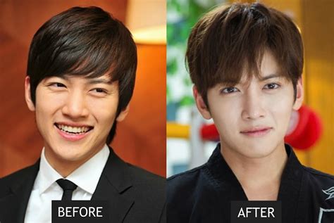 21 Korean Celebs Who Have Undergone Cosmetic Procedures Or Surgery ...