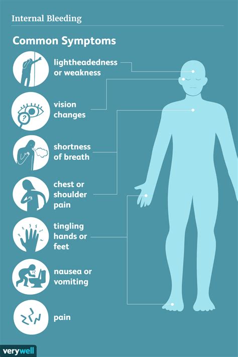 Internal Bleeding: Symptoms and How It's Treated