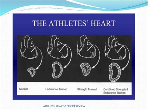 Athletes heart a short review