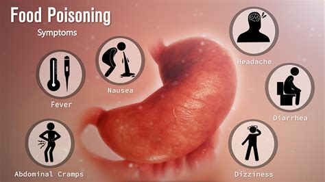 Food Poisoning Symptoms Shown & Explained Using A Medical Animation