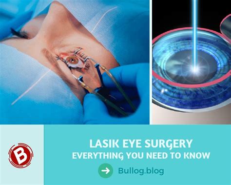 How LASIK Eye Surgery Works - Procedure, Risks, Cost and Recovery