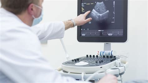 Imagex Medical’s Ultrasound Rental Service - Imagex Medical