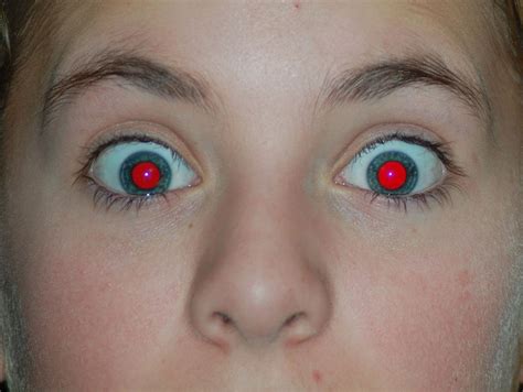 TIL that red eyes appear in photographs as a result of light reflecting ...