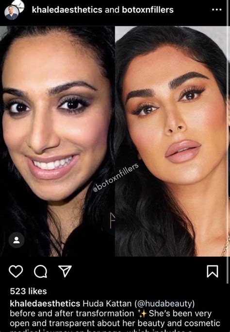 Mona and Huda Kattan before the surgery : r/dubaibling