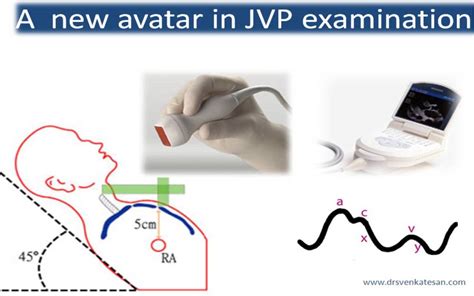 jugular venous pressure | Dr.S.Venkatesan MD