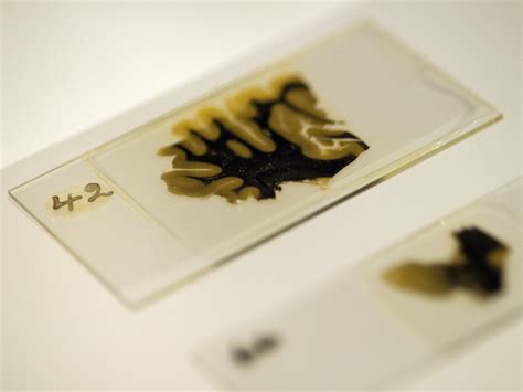 Scientists Get A New Look At Einstein's Brain | WBUR News