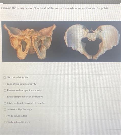 Examine the pelvis below. Choose all of the correct | Chegg.com