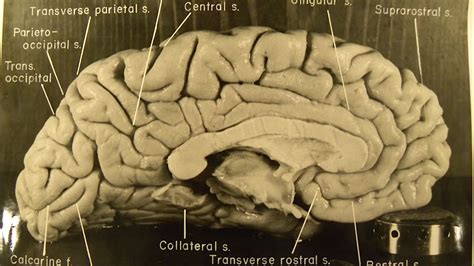 Studying the unique features of Albert Einstein's brain | Britannica