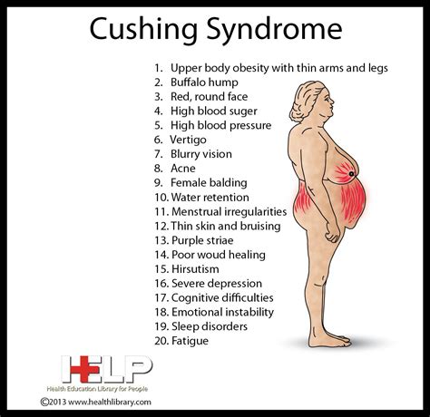 Cushing Syndrome | Medical surgical nursing, Surgical nursing, Cushings syndrome