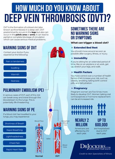 Deep Vein Thrombosis: Causes, Symptoms and Support Strategies