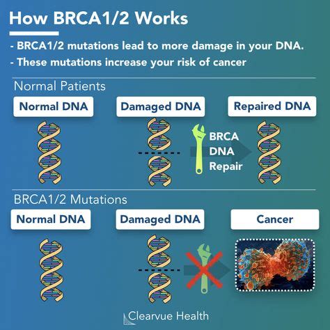 14 Brca 1 Mutation Gene Journey ideas in 2021 | brca, mutation, cancer