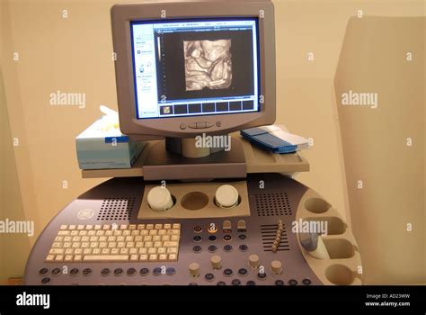 fetus cord echography pregnancy screen scan Stock Photo - Alamy