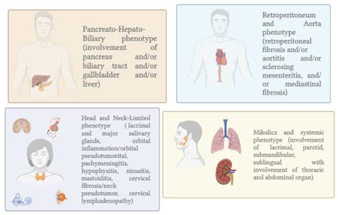 IJMS | Free Full-Text | Autoimmune Pancreatitis: From Pathogenesis to Treatment