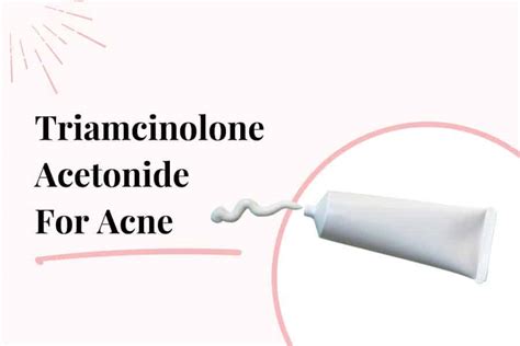 Triamcinolone Acetonide For Acne: Does It Work? - The Blushing Bliss