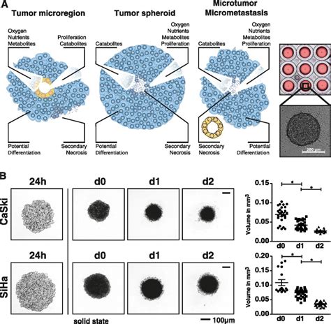 Tumor Spheroid Model