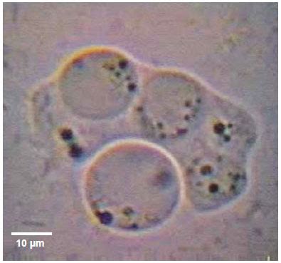 Trichomonas Hominis