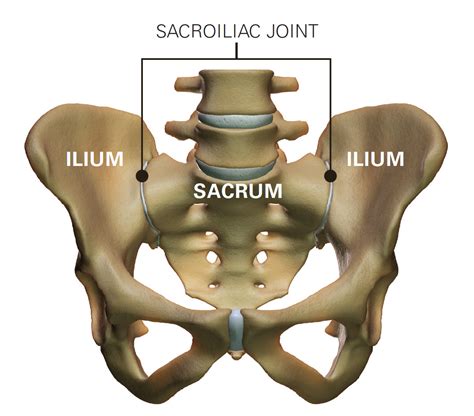 The Difference Between Sacroiliac Joint Dysfunction and Sciatica ...