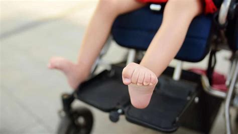 Understanding Spastic Quadriplegic Cerebral Palsy