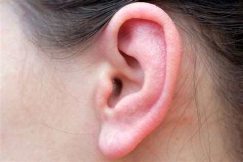 Dry Skin in Ears: Causes and Treatment