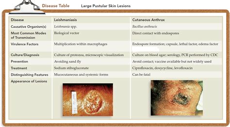 Pustular Skin Lesions