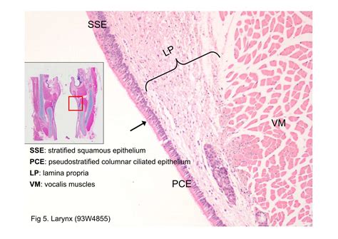 Block4/Fig 5. Larynx (93W4855)