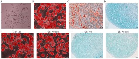 CFU‑F and differentiation assays. (A) Morphology of Giemsa‑stained ...