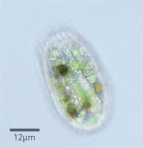 What is the Phylum Ciliophora?