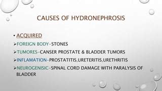 Hydronephrosis | PPT