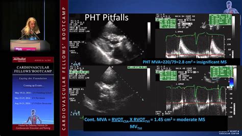 Mitral Stenosis (Karla Kurrelmeyer, MD) - YouTube