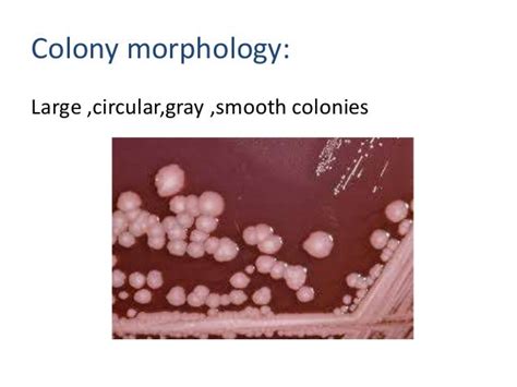 Proteus Mirabilis Colony Morphology Chart | Images and Photos finder