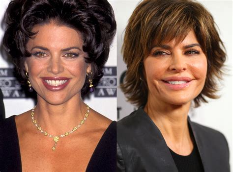 Lisa Rinna from Better or Worse: Celebs Who Have Had Plastic Surgery