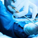 Keyhole surgery better for cancer hysterectomies | myVMC