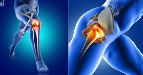 Joint Replacement Surgery - Types & Benefits | Step Ahead Clinic