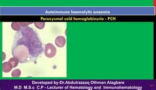 Paroxysmal cold hemoglobinuria -PCH | PPT