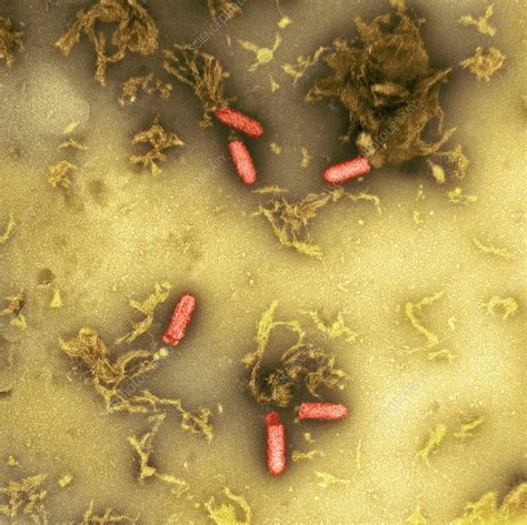 Rhabdovirus, TEM - Stock Image - M050/1257 - Science Photo Library