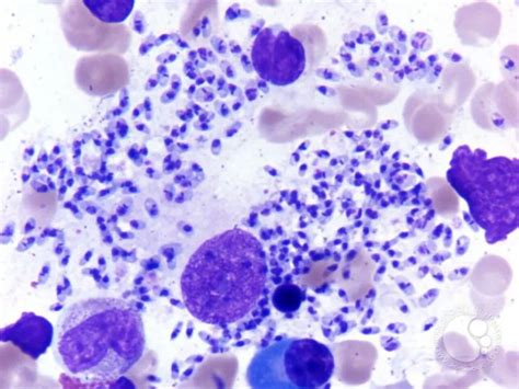 Giemsa Stain: Principle, Procedure, Results • Microbe Online