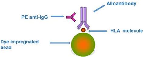 Frontiers | Detection of HLA Antibodies in Organ Transplant Recipients ...