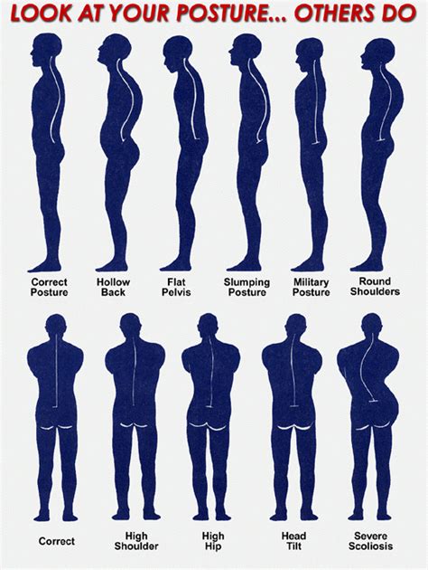 Bad Posture: Effects, Consequences, And Correction Gold Coast Chiropractor