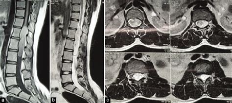 Surgical Neurology International